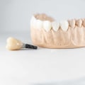 What are the Main Reasons for Dental Implant Failure?