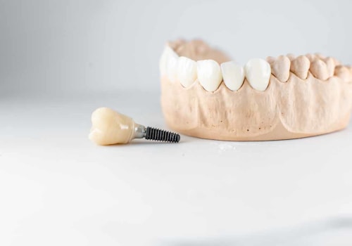What are the Main Reasons for Dental Implant Failure?